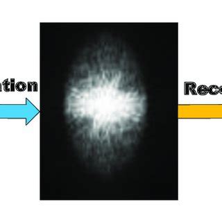 Application of Compressed Sensing in Magnetic Resonance Images (MRI) [4 ...