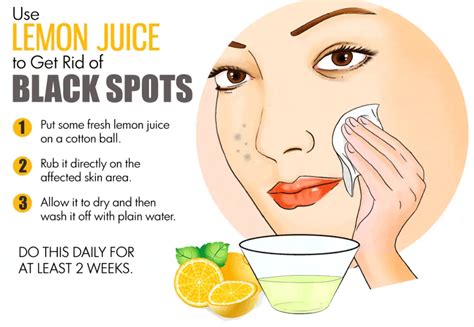 Remove Dark Spots Easily and Quickly With These Home Remedies