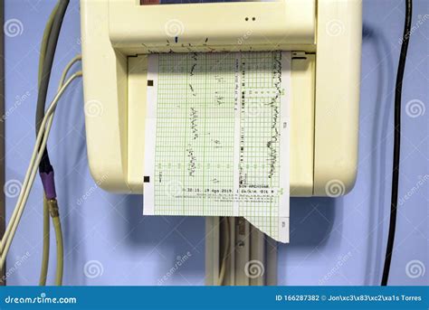 Electrocardiogram Machine Used in Hospital Stock Photo - Image of ...