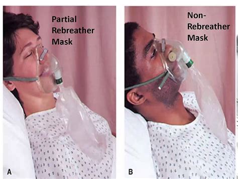 Difference Between Partial Rebreather Mask And Non Rebreather Mask