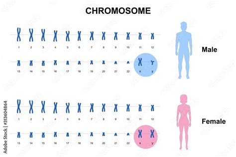 Autosome Sex Chromosome Normal Human Karyotype Stock | Hot Sex Picture