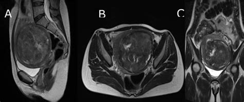 MRI scan prior to the operation | Download Scientific Diagram