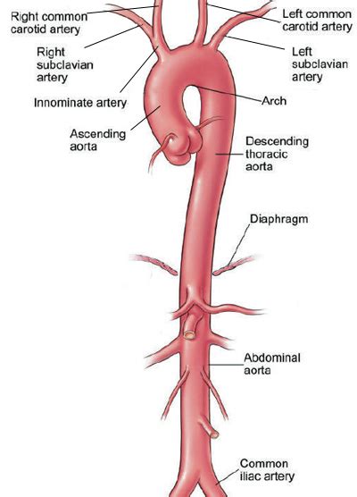 Aorta: Aortic Aneurysm | Cleveland Clinic