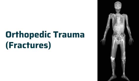 Orthopedic Trauma (Fracture) Treatment | Ahmedabad | Dr. Rachit Sheth