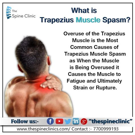 WHAT IS TRAPEZIUS MUSCLE SPASM. WHAT IS TRAPEZIUS MUSCLE SPASM | by The ...