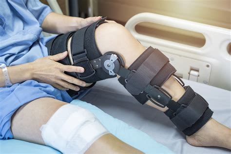 Do I Need to Wear a Knee Brace After ACL Surgery? — Dr. Bill Sterett