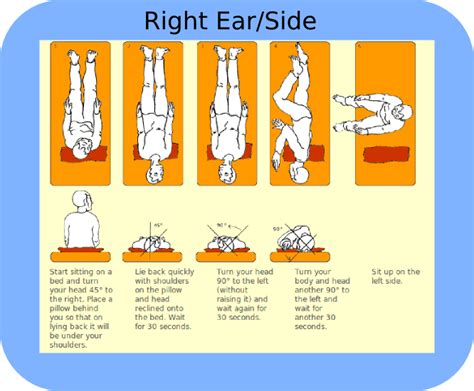 Epley Maneuver | Tampa Bay Hearing