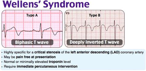 Wellens' syndrome | Medical school studying, Emergency nursing, Nursing ...