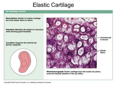 Cartilage & bones