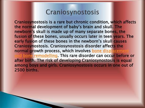 PPT - Craniosynostosis: Types, Causes, Symptoms, Diagnosis and ...