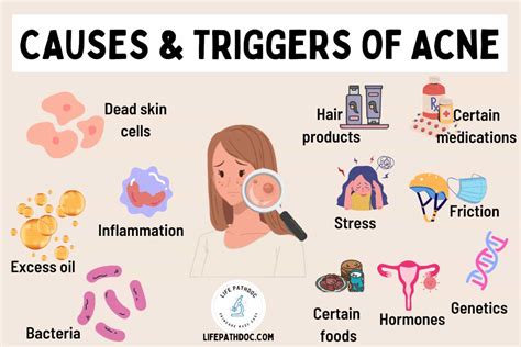 Causes and Triggers of Acne: Why Do You Get Pimples?