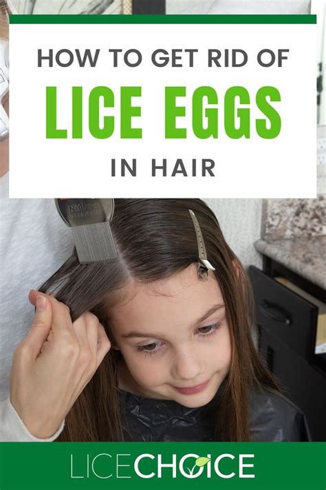 Lice Eggs (Nits) - A COMPLETE guide with answers to all your questions ...