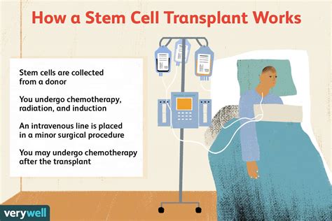 Stem Cell Transplant for Multiple Myeloma