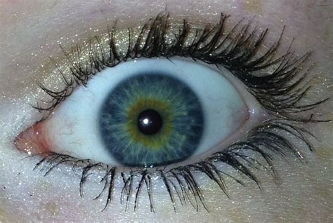 Central heterochromia. I finally found out what this is called! This is ...