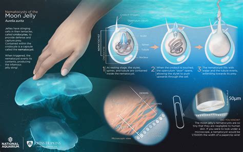 Jellyfish Sting - Symptoms, How To Treat A Jellyfish Sting