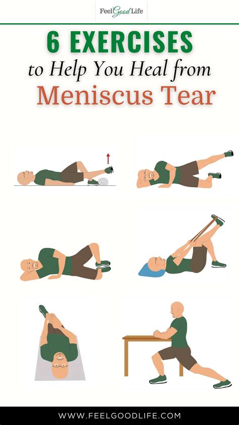 Torn meniscus exercises – Artofit