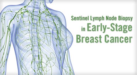 Early stage swollen lymph nodes in neck cancer - rytedashboard