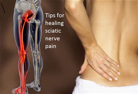 10 Tips for healing sciatic nerve pain according to health articles ...