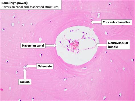 Bone – Normal Histology – NUS Pathweb :: NUS Pathweb