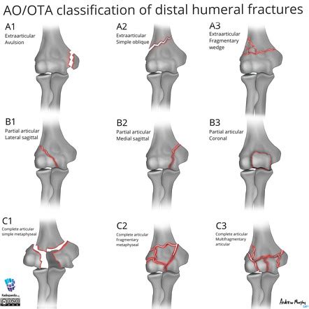 Distal Humerus Anatomy