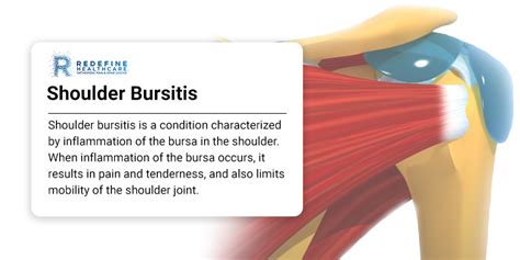 Shoulder Bursitis Treatment in New Jersey | Redefine Healthcare