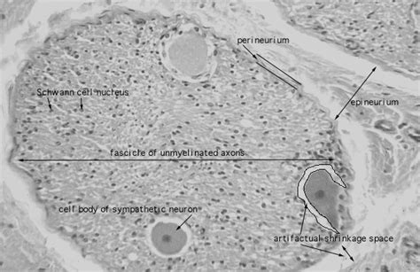 HLS [ Nervous Tissue and Neuromuscular Junction, unmyelinated nerve ...