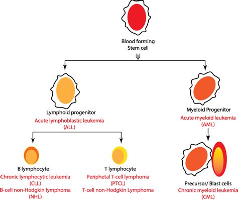 Origin of different subtypes of blood cancer (red) with respective ...