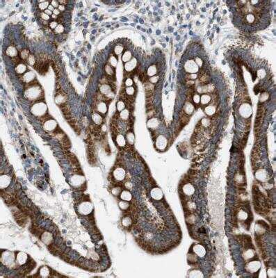 Tryptophan Hydroxylase 1/TPH-1 Antibody (NBP1-86922): Novus Biologicals