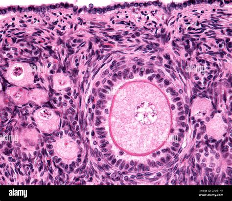 Light micrograph of an ovarian primary follicle showing the oocyte ...