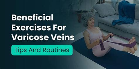 Beneficial Exercises for Varicose Veins: Tips and Routines