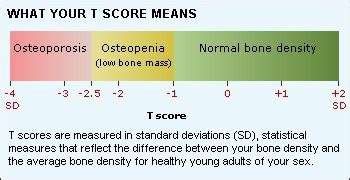 Bone Density (DEXA) - Peninsula Imaging