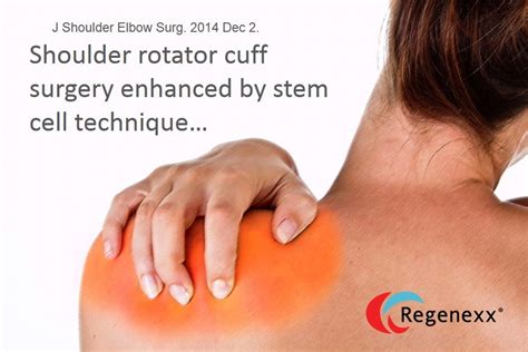 Shoulder Surgery Stem Cell Therapy?