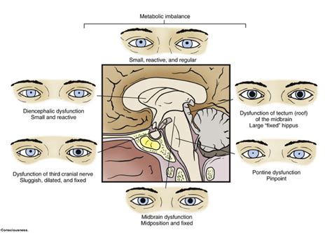 Level of Consciousness Diagram | Quizlet