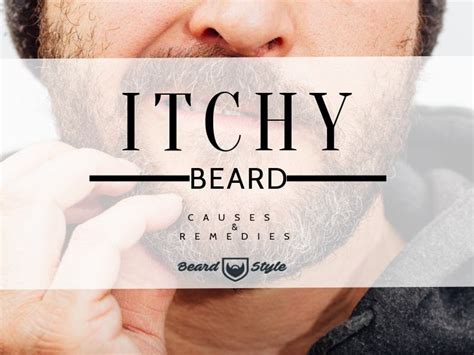 Itchy Beard: Causes and How to Get Rid of It – BeardStyle