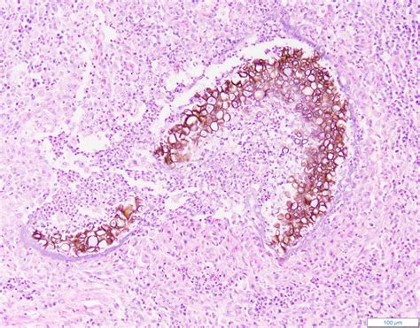 Image: Phaeohyphomycosis, dog - MSD Veterinary Manual