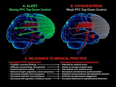 The higher cognitive functions of the prefrontal cortex are impaired by ...