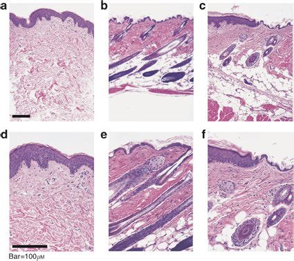 Histological comparison of normal human (a, d), mouse skin (b, e) and ...