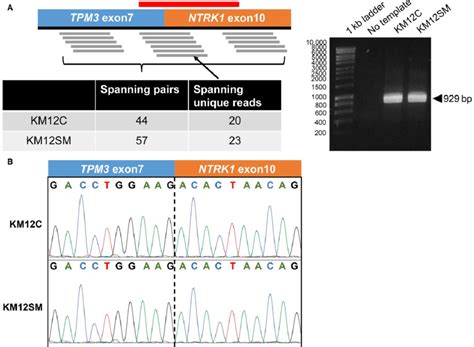 KM12C and KM12SM cells harbor the TPM3-NTRK1 gene fusion. (A) Schematic ...