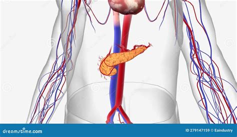 It is Called Pancreatic Adenocarcinoma Cancer that Arises from E Stock ...