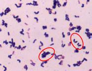 Microbiology: Gram positive Bacilli 1: Bacillus and Cornybacterium ...