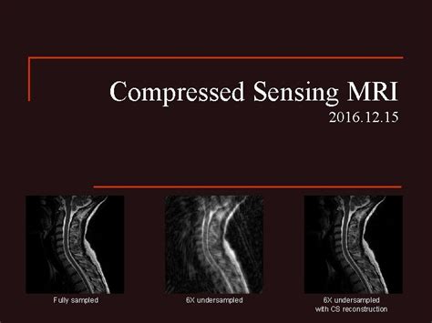 Compressed Sensing MRI 2016 12 15 Fully sampled