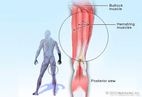 Hamstring Strain - Pure Physio Albany NZ hamstring strains