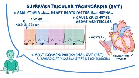 Arrhythmias Supraventricular Tachycardia Svt Nursing Osmosis