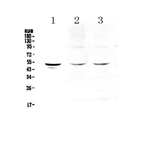 Tryptophan Hydroxylase/TPH1 Antibody