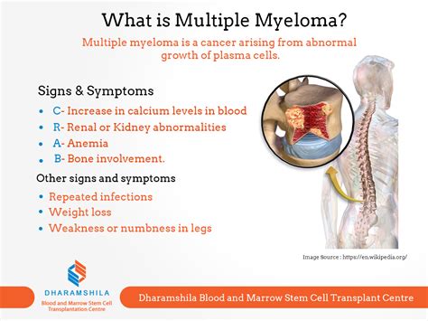 Symptoms Multiple Myeloma