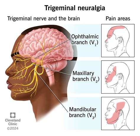 Trigeminal Nerve Pathway