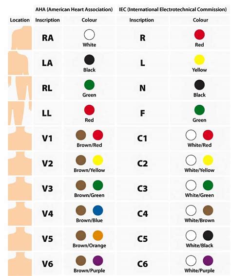 12 Lead Ecg Placement Color Coded