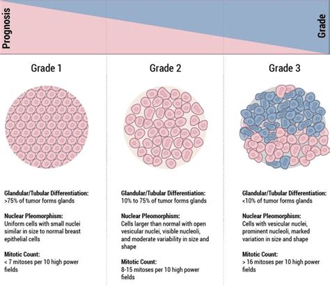 Staging & Grade - Breast Cancer | Johns Hopkins Pathology