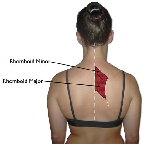 Diagram of the Rhomboid Muscles Shoulder Muscle Anatomy, Neck And ...