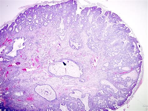 Endocervix Histology